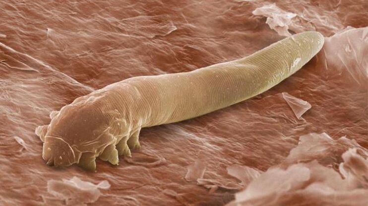 červ, ktorý žije pod ľudskou kožou