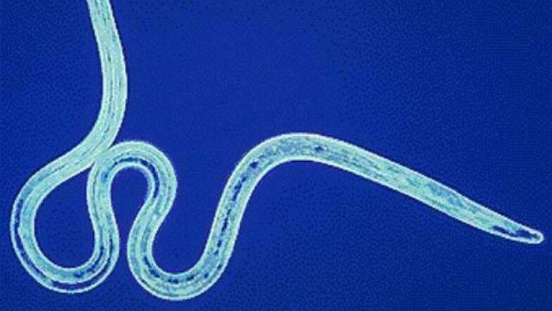Filaria