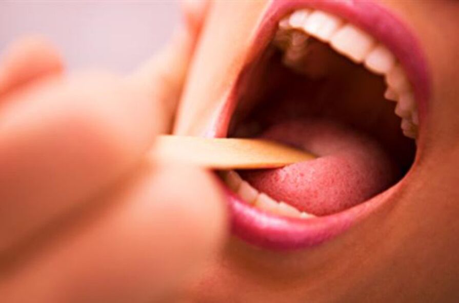 druhy parazitov v ľudských ústach